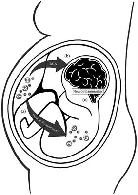 Impact of respiratory viral infections during pregnancy on the neurological outcomes of the newborn: current knowledge